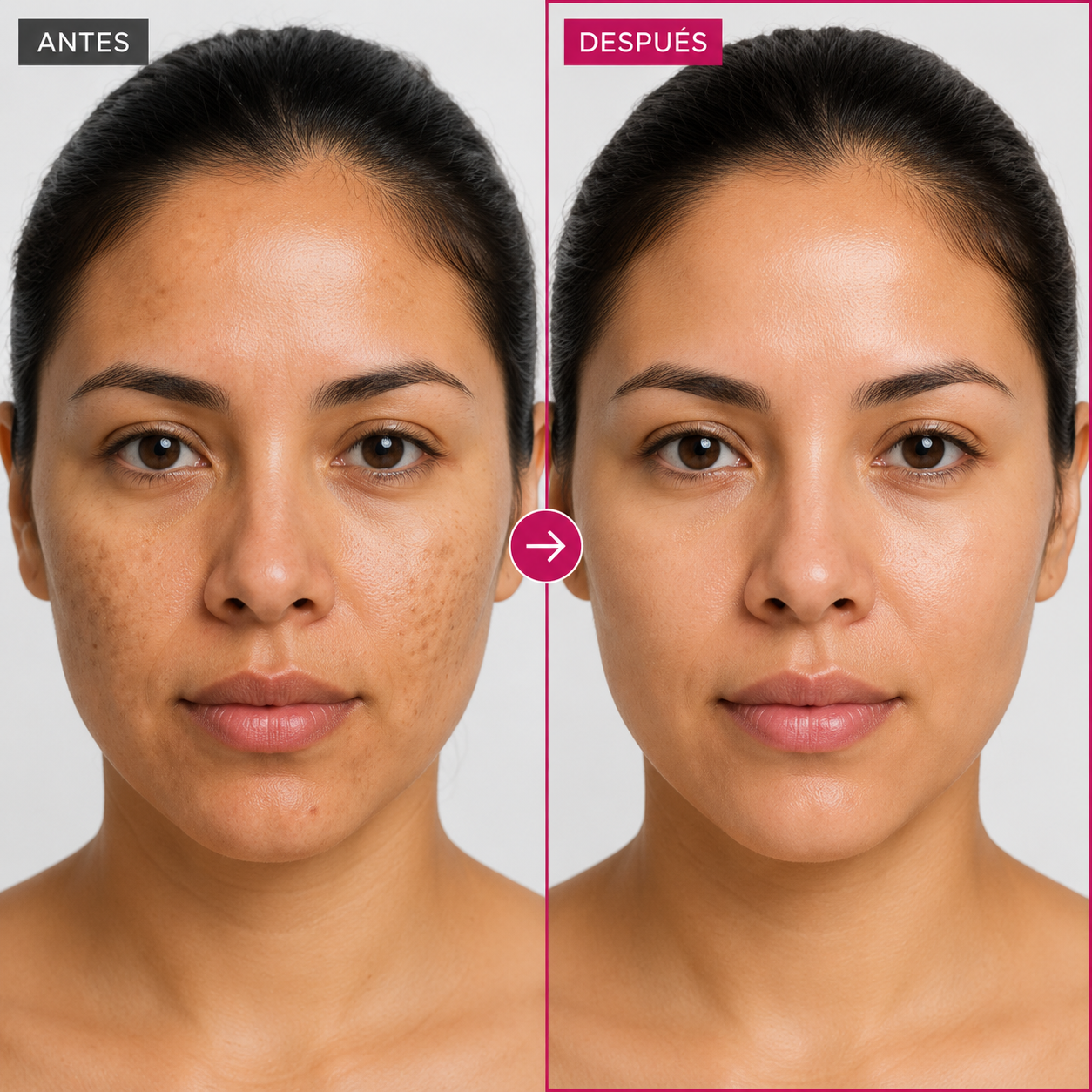 Pigment Balance 7+4 | Crema Anti-Manchas