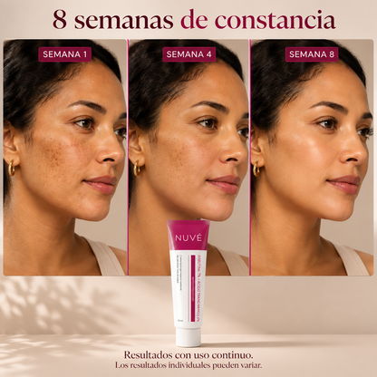 Pigment Balance 7+4 | Crema Anti-Manchas